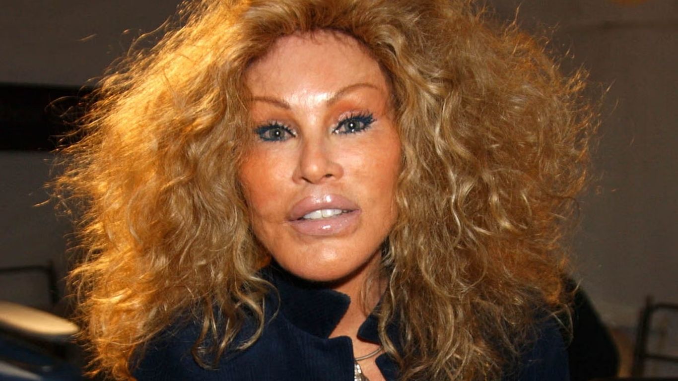 Jocelyn Wildenstein